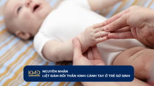 iet-dam-roi-than-kinh-canh-tay